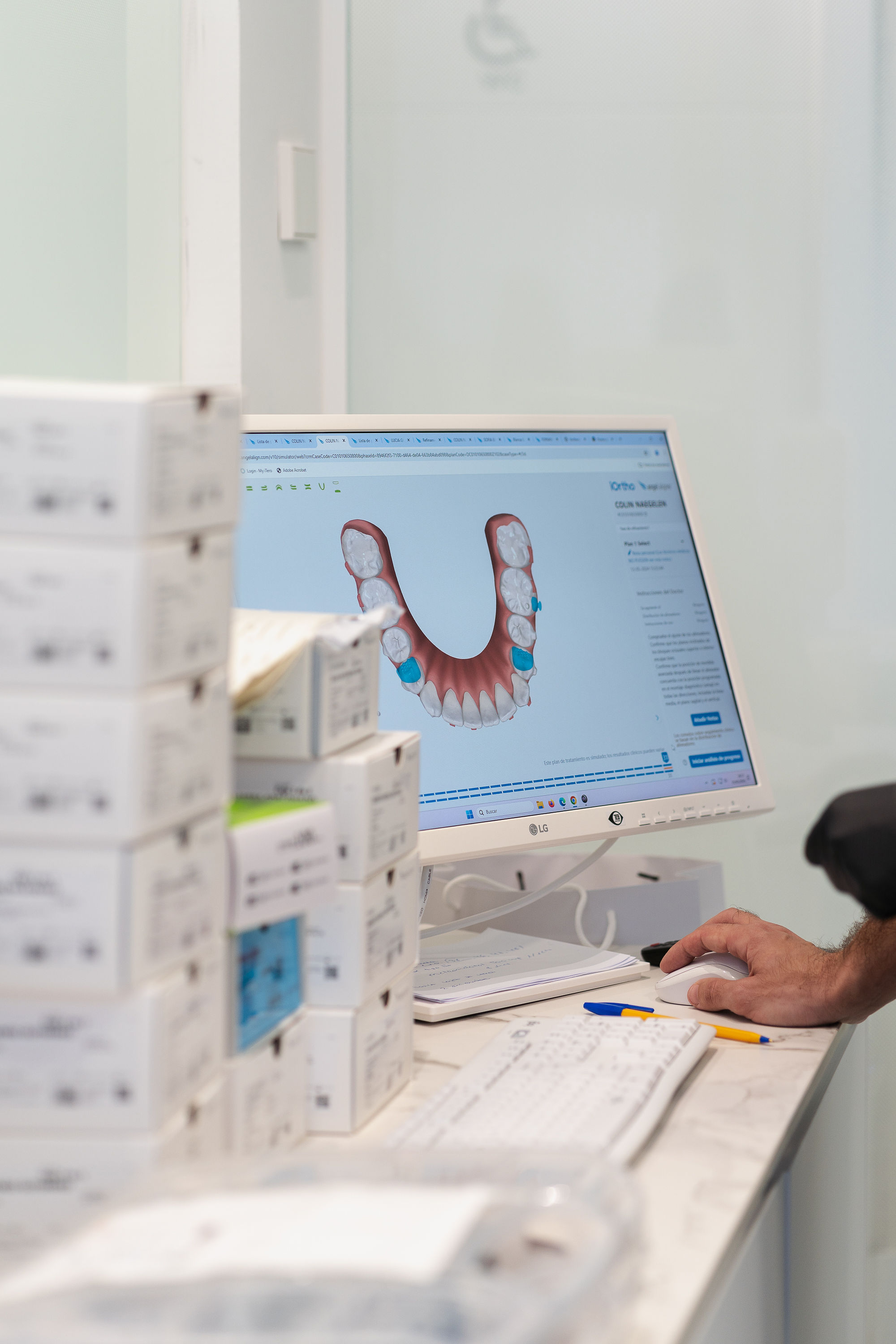iTero intraoral scanner in use